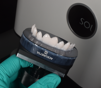 3D Printed Veneers with Ackuretta SOL & Pac-Dent Rodin Titan