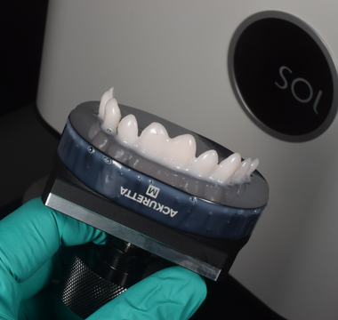 3D Printed Veneers with Ackuretta SOL & Pac-Dent Rodin Titan