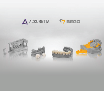 Ackuretta and BEGO interview about 3D printing materials