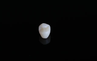 Why Dental 3D Printing Is a Smart Investment?