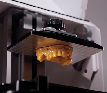 Ackuretta 3D printing solution, 3D printed dental model on SOL