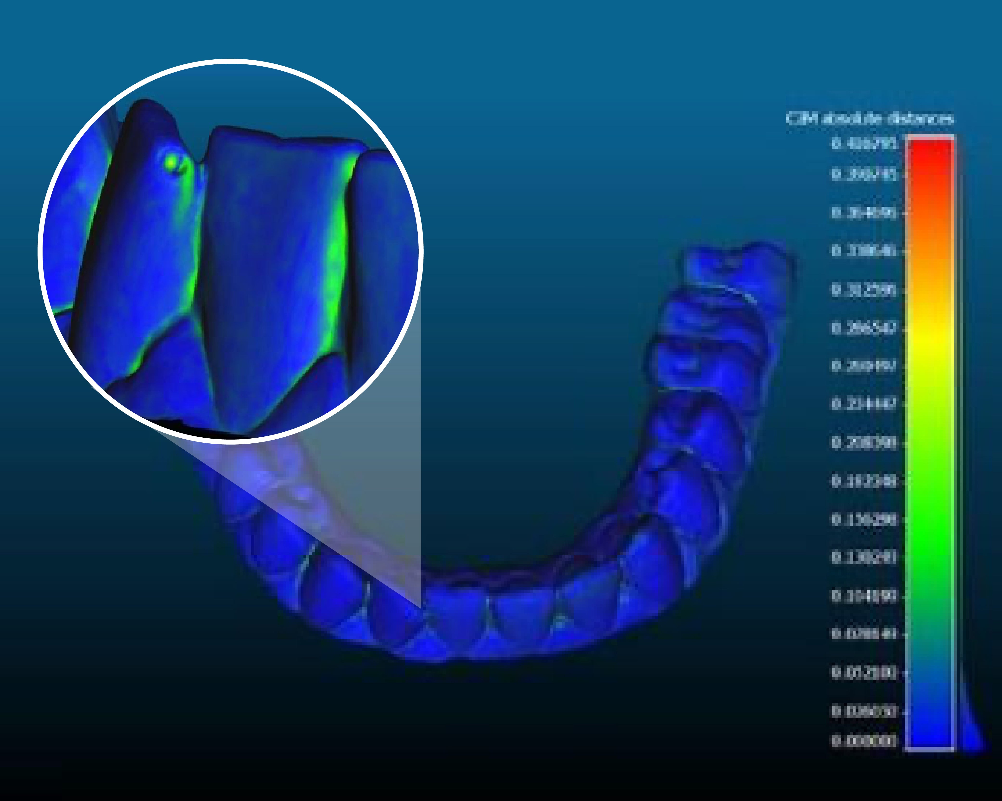Read before buying an Intraoral Scanner for Dental 3D Printing – Ackuretta