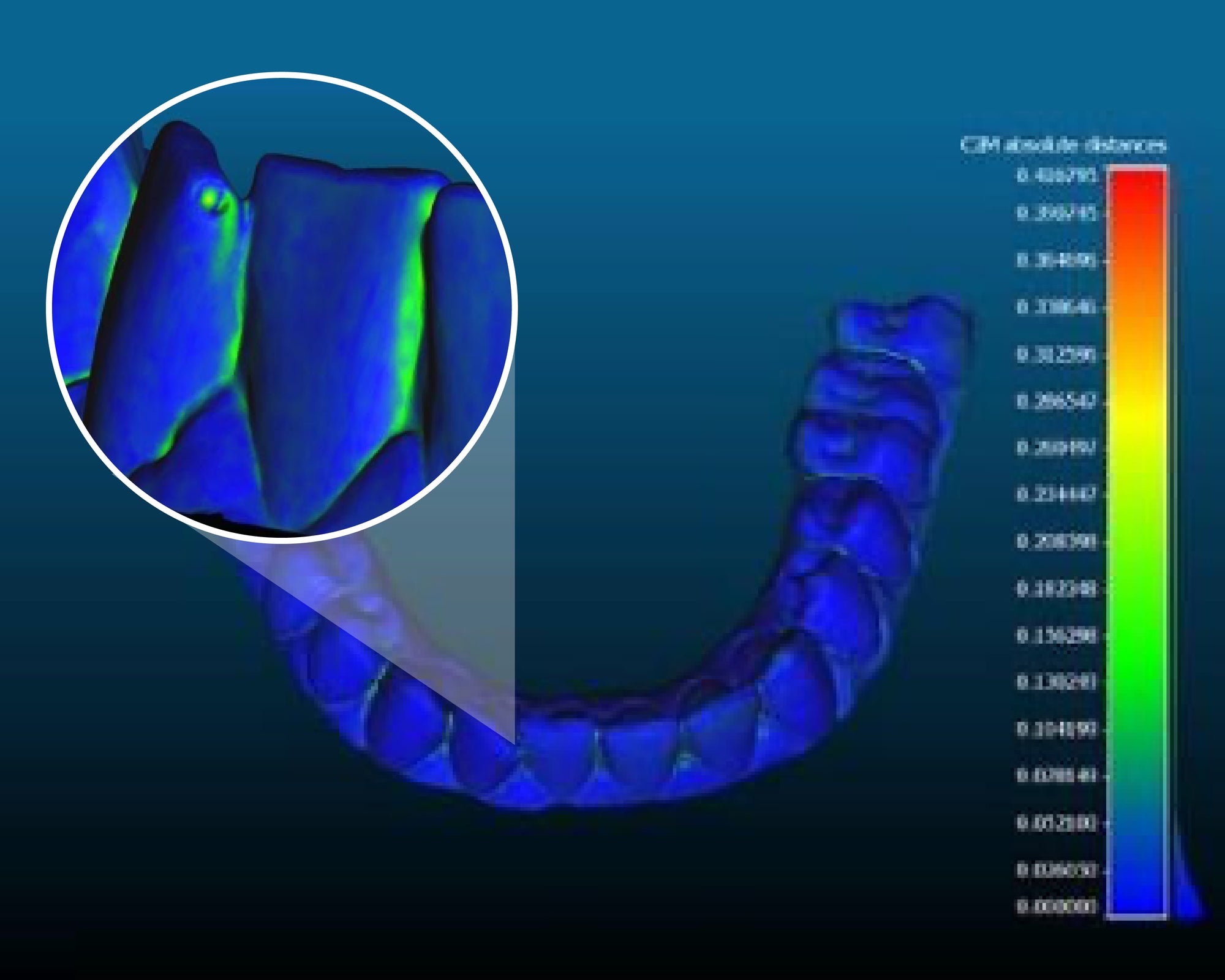 Read before buying an Intraoral Scanner for Dental 3D Printing