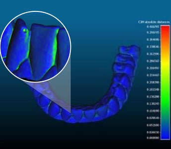 Read before buying an Intraoral Scanner for Dental 3D Printing