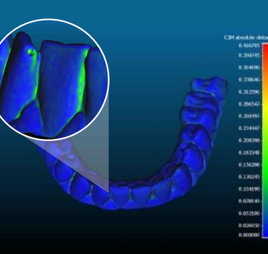 Read before buying an Intraoral Scanner for Dental 3D Printing