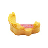 CURO Gingiva print on an implant model